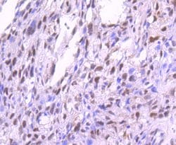 Invitrogen Phospho-PKC alpha (Thr638) Recombinant Rabbit Monoclonal Antibody