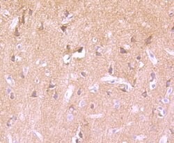 Invitrogen Phospho-PKC alpha (Thr638) Recombinant Rabbit Monoclonal Antibody