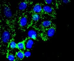 Invitrogen Fibronectin Recombinant Rabbit Monoclonal Antibody (JF0582)