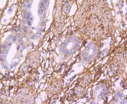 Invitrogen Fibronectin Recombinant Rabbit Monoclonal Antibody (JF0582)