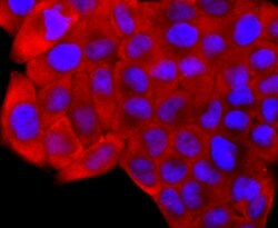 Invitrogen S100A6 Recombinant Rabbit Monoclonal Antibody (JF0976) 100 &mu;L;