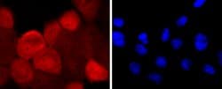 Invitrogen S100A6 Recombinant Rabbit Monoclonal Antibody (JF0976) 100 &mu;L;
