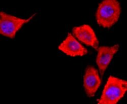 Invitrogen S100A6 Recombinant Rabbit Monoclonal Antibody (JF0976) 100 &mu;L;