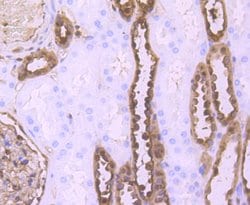 Invitrogen S100A6 Recombinant Rabbit Monoclonal Antibody (JF0976) 100 &mu;L;