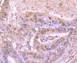 Invitrogen S100A6 Recombinant Rabbit Monoclonal Antibody (JF0976) 100 &mu;L;