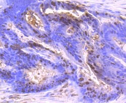 Invitrogen S100A6 Recombinant Rabbit Monoclonal Antibody (JF0976) 100 &mu;L;