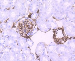 Invitrogen S100A6 Recombinant Rabbit Monoclonal Antibody (JF0976) 100 &mu;L;