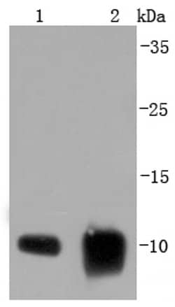 Invitrogen S100A6 Recombinant Rabbit Monoclonal Antibody (JF0976) 100 &mu;L;