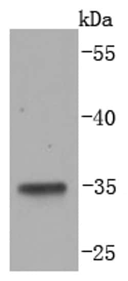 Invitrogen LYVE1 Recombinant Rabbit Monoclonal Antibody (JF0979) 100 &mu;L;
