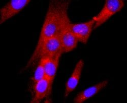 Invitrogen gamma Tubulin Recombinant Rabbit Monoclonal Antibody (JF0972)