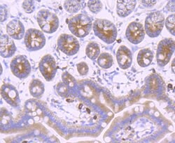 Invitrogen gamma Tubulin Recombinant Rabbit Monoclonal Antibody (JF0972)