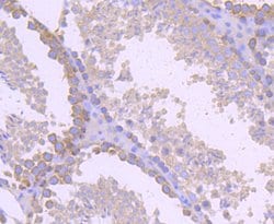 Invitrogen gamma Tubulin Recombinant Rabbit Monoclonal Antibody (JF0972)
