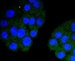 Cardiac Troponin I Recombinant Rabbit Monoclonal Antibody (JF0550):Antibodies,