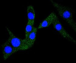 Cardiac Troponin I Recombinant Rabbit Monoclonal Antibody (JF0550):Antibodies,