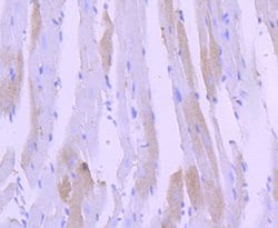 Cardiac Troponin I Recombinant Rabbit Monoclonal Antibody (JF0550):Antibodies,