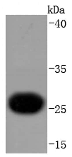 Cardiac Troponin I Recombinant Rabbit Monoclonal Antibody (JF0550):Antibodies,