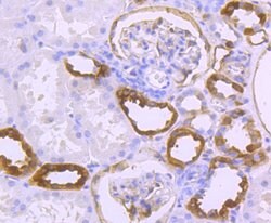 Invitrogen S100A10 Recombinant Rabbit Monoclonal Antibody (JF0987) 100 &mu;L | Buy Online | Invitrogen&trade; | Fisher Scientific