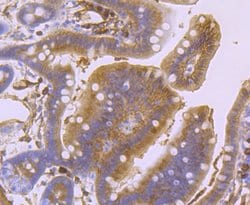 Invitrogen S100A10 Recombinant Rabbit Monoclonal Antibody (JF0987) 100 &mu;L | Buy Online | Invitrogen&trade; | Fisher Scientific