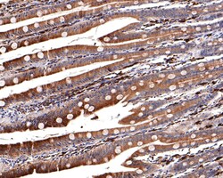 Invitrogen HMGCR Recombinant Rabbit Monoclonal Antibody (JF0981) 100 &mu;L | Buy Online | Invitrogen&trade; | Fisher Scientific