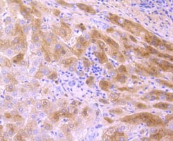 Invitrogen Transthyretin Recombinant Rabbit Monoclonal Antibody (JF1016) 100 &mu;L | Buy Online | Invitrogen&trade; | Fisher Scientific