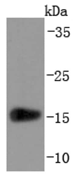 Invitrogen Transthyretin Recombinant Rabbit Monoclonal Antibody (JF1016) 100 &mu;L | Buy Online | Invitrogen&trade; | Fisher Scientific