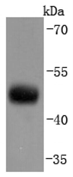 Invitrogen CNPase Recombinant Rabbit Monoclonal Antibody (JF10-25) 100