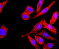 Invitrogen HLA-AB Recombinant Rabbit Monoclonal Antibody (JF10-38) 100 &mu;L | Buy Online | Invitrogen&trade; | Fisher Scientific