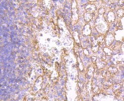 Invitrogen HLA-AB Recombinant Rabbit Monoclonal Antibody (JF10-38) 100 &mu;L | Buy Online | Invitrogen&trade; | Fisher Scientific