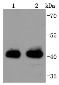 Invitrogen HLA-AB Recombinant Rabbit Monoclonal Antibody (JF10-38) 100 &mu;L | Buy Online | Invitrogen&trade; | Fisher Scientific