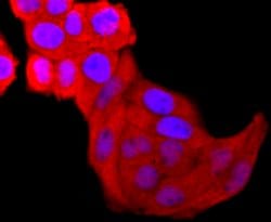 Invitrogen Galectin 3 Recombinant Rabbit Monoclonal Antibody (JF39-10)