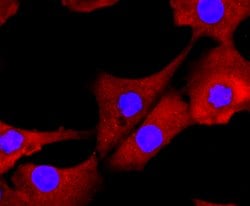 Invitrogen Galectin 3 Recombinant Rabbit Monoclonal Antibody (JF39-10)