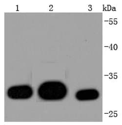 Invitrogen Galectin 3 Recombinant Rabbit Monoclonal Antibody (JF39-10)