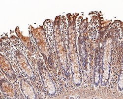 Invitrogen Galectin 3 Recombinant Rabbit Monoclonal Antibody (JF39-10)