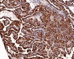 Invitrogen Galectin 3 Recombinant Rabbit Monoclonal Antibody (JF39-10)