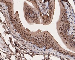 Invitrogen Galectin 3 Recombinant Rabbit Monoclonal Antibody (JF39-10)