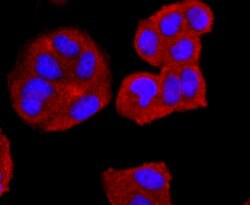 Invitrogen CD74 Recombinant Rabbit Monoclonal Antibody (JF40-10) 100 &mu;L;