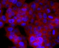 Invitrogen CD74 Recombinant Rabbit Monoclonal Antibody (JF40-10) 100 &mu;L;