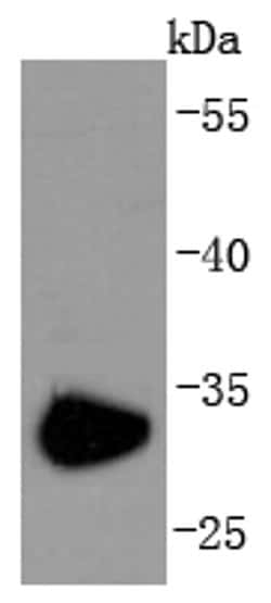 Invitrogen CD74 Recombinant Rabbit Monoclonal Antibody (JF40-10) 100 &mu;L;