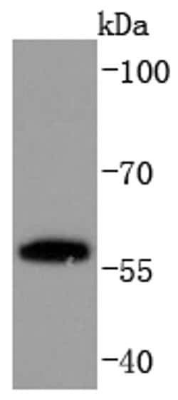 Invitrogen PPAR gamma Recombinant Rabbit Monoclonal Antibody (JF101-4)