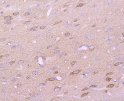 Invitrogen CD147 Recombinant Rabbit Monoclonal Antibody (JF1-045) 100 &mu;L | Buy Online | Invitrogen&trade; | Fisher Scientific