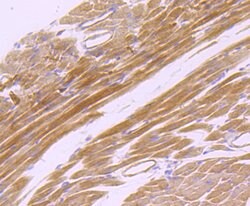 Invitrogen CD147 Recombinant Rabbit Monoclonal Antibody (JF1-045) 100 &mu;L | Buy Online | Invitrogen&trade; | Fisher Scientific
