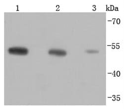 Invitrogen beta Tubulin Recombinant Rabbit Monoclonal Antibody (JF41-50), HRP 100 &mu;L | Buy Online | Invitrogen&trade; | Fisher Scientific