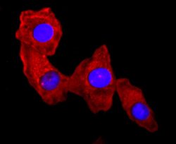 Invitrogen S100A9 Recombinant Rabbit Monoclonal Antibody (JF096-8) 100