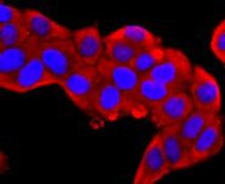Invitrogen S100A9 Recombinant Rabbit Monoclonal Antibody (JF096-8) 100