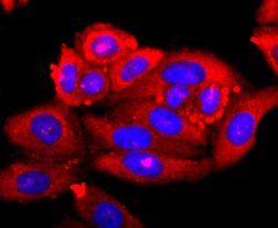 Invitrogen S100A9 Recombinant Rabbit Monoclonal Antibody (JF096-8) 100
