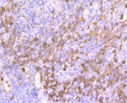 Invitrogen S100A9 Recombinant Rabbit Monoclonal Antibody (JF096-8) 100