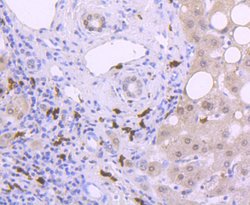 Invitrogen S100A9 Recombinant Rabbit Monoclonal Antibody (JF096-8) 100