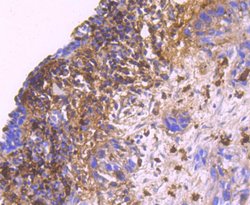 Invitrogen S100A9 Recombinant Rabbit Monoclonal Antibody (JF096-8) 100