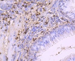 Invitrogen S100A9 Recombinant Rabbit Monoclonal Antibody (JF096-8) 100