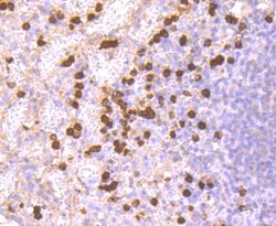 Invitrogen S100A9 Recombinant Rabbit Monoclonal Antibody (JF096-8) 100